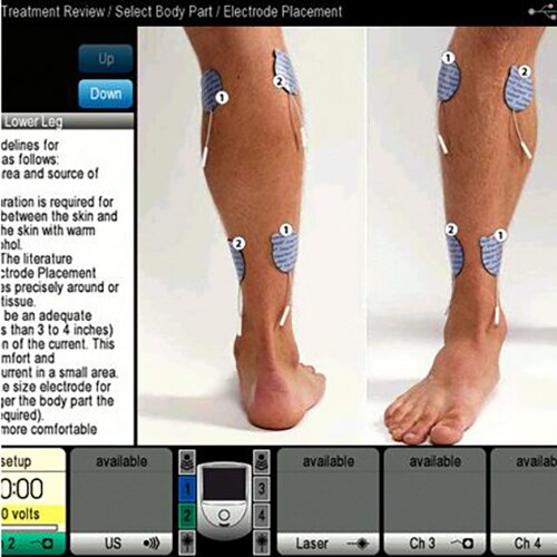 Intelect Neo Stim 2 Channels